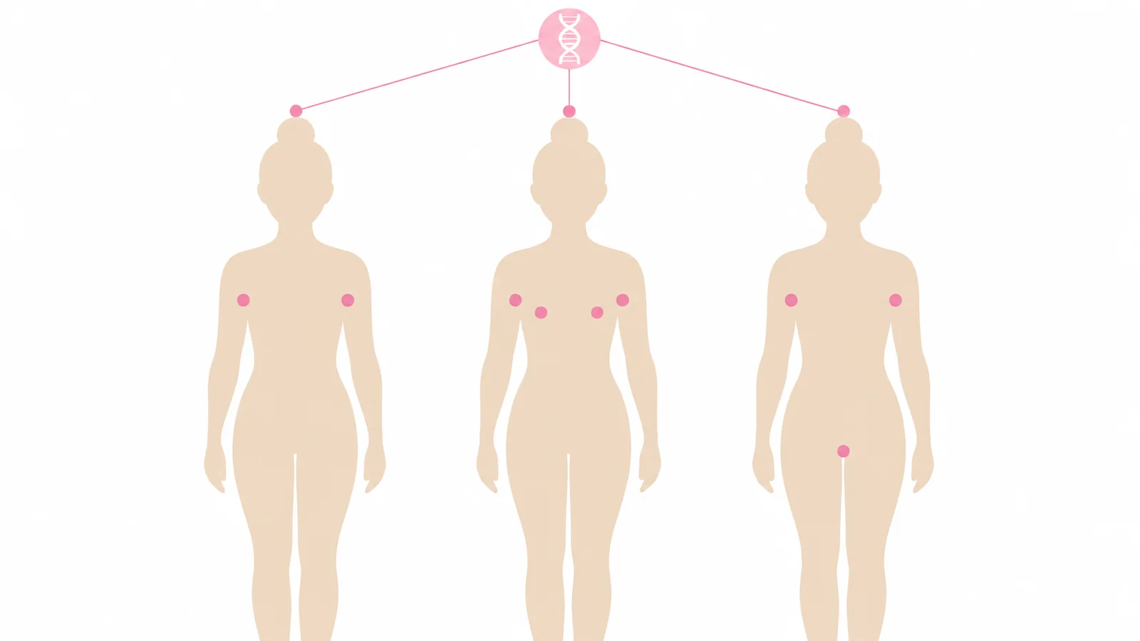 同じ腋臭体質でも、においが出る場所は人によって違うことを示す3人の女性のシルエット。ワキだけ、ワキと乳輪、ワキとデリケートゾーン