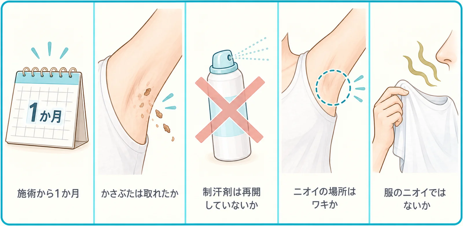 判定の前に確かめる5つのこと（施術から1か月・かさぶた・制汗剤の再開・ニオイの場所・服のニオイ）の図